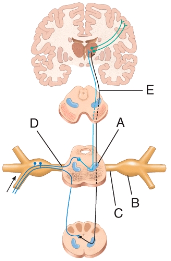 Which of the labeled structures in the diagram of the trigeminothalamic pathway is the trigeminal ganglion?   A) A B) B C) C D) D E) E