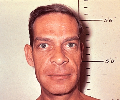 The patient shown is suffering from a disease called ____________,caused by a pituitary hypersecretion of hGH during adulthood.   A) Goiter B) Graves' Disease C) Acromegaly D) Cushing's syndrome E) Giantism