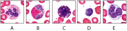 Which of the cells in the diagram can be subdivided into categories of small and large versions of this cell type?   A) A B) B C) C D) D E) E