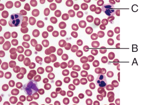 Which labeled cell in the diagram is a WBC?   A) A B) B C) C D) Both B and C E) All of these choices