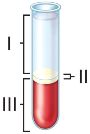 Which of the following types of proteins is present at the lowest percentage of the blood component labeled I in the figure?   A) globulin B) albumin C) fibrinogen D) all of the protein listed are found in equal percentages E) none of proteins listed are found in component I