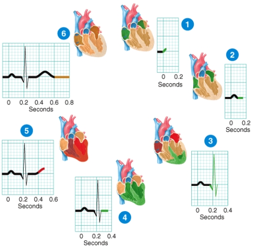 Briefly describe what is happening at stage of the ECG labeled 5 in the diagram.   