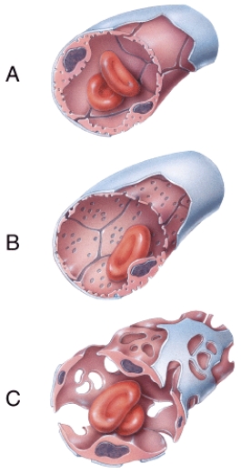 Which of the types of capillaries shown in the figure is commonly found in the kidneys,villi of the small intestine,choroid plexuses,and some endocrine glands?   A) A B) B C) C D) A and B E) B and C