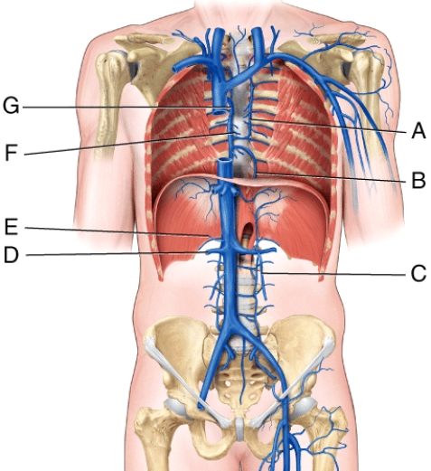 Which vessel in the figure is labeled  D ?   A) accessory hemiazygos vein B) hemiazygos vein C) right renal vein D) right suprarenal vein E) pericardial vein