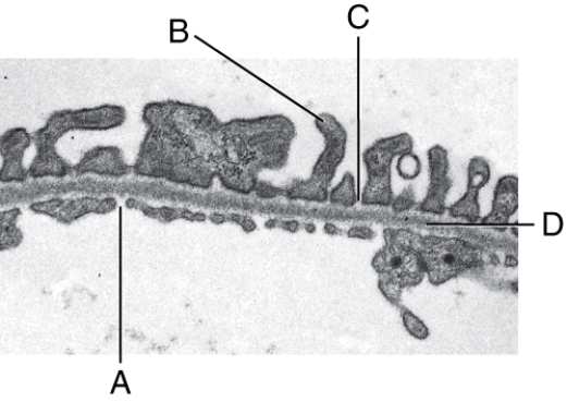 What is line  C  pointing to?   A) Fenestration B) Pedicel C) Filtration slit D) Basal lamina E) Lumen of the glomerulus