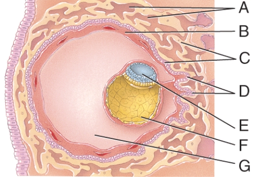 What is line  G  pointing to?   A) chorion B) chorionic villi C) sinusoid D) extraembryonic mesoderm E) None of these choices