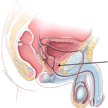 What is the structure indicated in the figure?   A)  urinary bladder B)  testis C)  bulbourethral gland D)  prostate