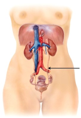 What is the structure that is indicated on the diagram?   A)  right renal artery B)  left renal vein C)  left ureter D)  left urethra