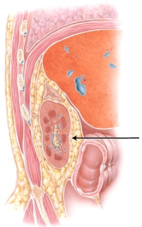 What structure is the arrow is pointing to?   A)  suprarenal gland B)  adipose capsule C)  quadratus lumborum D)  peritoneum