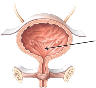 What is the structure or area that the arrow is pointing to?   A)  peritoneum B)  internal urethral sphincter C)  detrusor muscle D)  trigone
