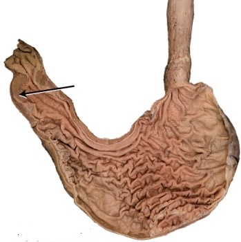What is the structure the arrow is pointing to?   A)  rugae B)  fundus C)  cardia D)  pyloric sphincter