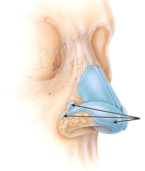 Which cartilages are indicated in the figure?   A)  nasal B)  lateral C)  septal D)  alar
