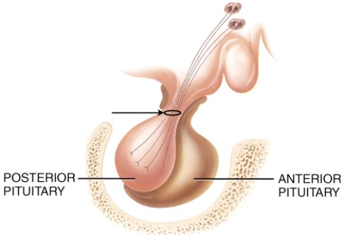 The arrow is pointing to which structure?   A)  paraventricular nucleus B)  supraoptic nucleus C)  infundibular venous plexus D)  axons of neurosecretory cells