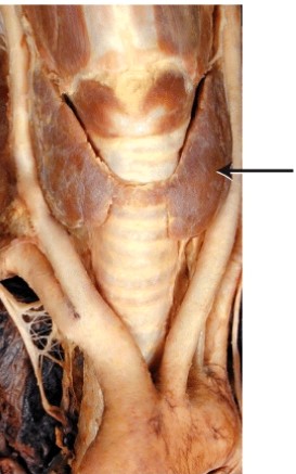 What is the endocrine gland labeled with the arrow?   A)  pituitary B)  thymus C)  pancreas D)  thyroid