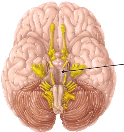 This structure arises from the _____.   A)  telencephalon. B)  mesencephalon. C)  metencephalon. D)  diencephalon.
