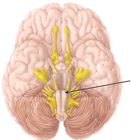 The structure indicated by the arrow   A)  is where the rubrospinal tract begins. B)  is where the corticospinal tract decussates. C)  is where the spinothalamic tract crosses. D)  is where third-order neurons of the posterior (dorsal)  column tract originate.