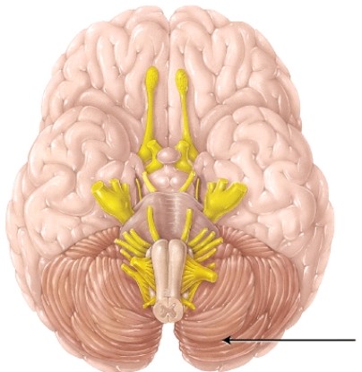 The structure indicated by the arrow is separated from the occipital lobe of the cerebrum by the   A)  transverse fissure B)  longitudinal fissure C)  central sulcus D)  lateral sulcus