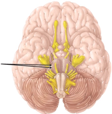 The structure indicated by the arrows is the   A)  cerebral peduncle B)  medullary pyramid C)  vermis D)  cerebellar peduncle