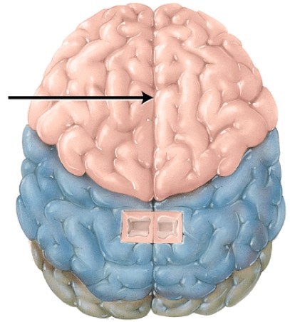 What collection of commissural fibers is located deep in this structure?   A)  association tracts B)  corpus callosum C)  internal capsule D)  projections tracts