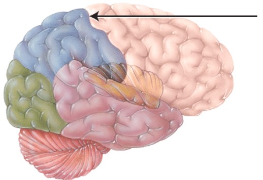 This structure separates what two cerebral lobes?   A)  temporal and parietal B)  frontal and parietal C)  temporal and occipital D)  occipital and parietal