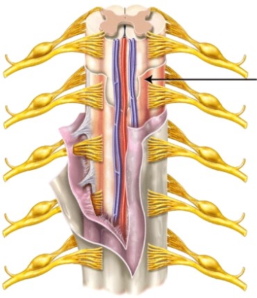 The meninx indicated by the line is the _____   A)  pia mater B)  arachnoid mater C)  dura mater
