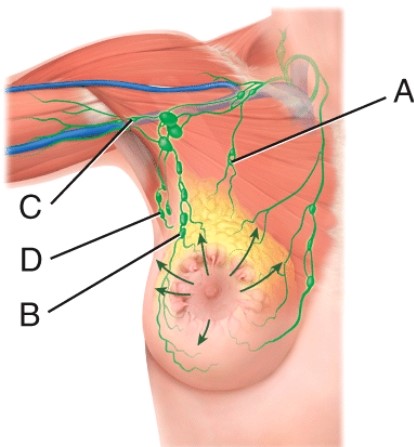More than 75% of the lymph drainage of the breast is to the _____. In breast cancer, it is possible that cancer cells leave the breast and lodge in these nodes. From here, metastasis may develop in other axillary nodes.   A)  A B)  B C)  C D)  D