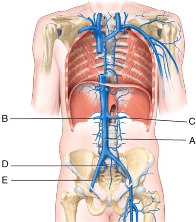 The left testicular (or ovarian)  vein drains into the _____, whereas the right testicular (or ovarian)  vein drains into the _____.   A)  A; B B)  B; C C)  D; E D)  C; A