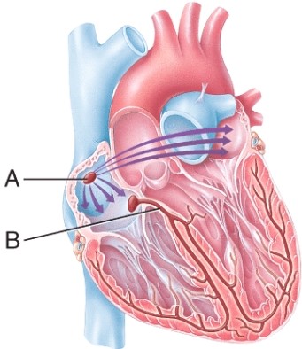 Match the component of the conduction system of the heart with the description. Sinoatrial (SA)  node:   A)  sends wave of depolarization throughout atria B)  located in the interatrial septum