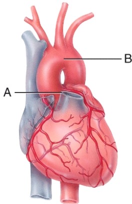 Match the vessel with the description. Aorta:   A)  carries oxygenated blood away from the heart B)  carries deoxygenated blood away from the heart