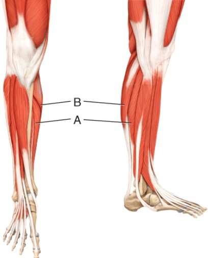 What muscle is indicated by line A?  