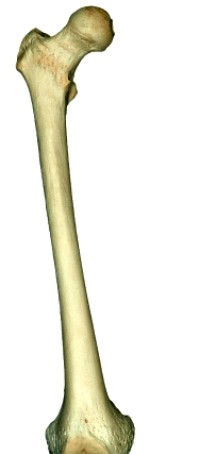Visible in this view of the femur is/are the   A)  greater and lesser trochanters near the proximal end B)  intercondylar fossa at the proximal end C)  linea aspera D)  Acetabulum