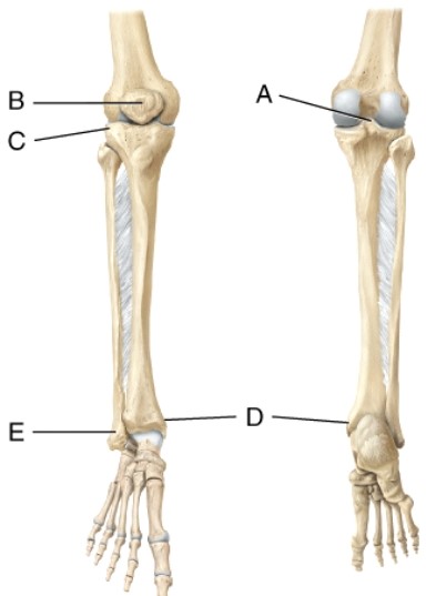 Identify the medial malleolus.   A)  A B)  B C)  C D)  D E)  E