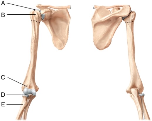 Identify the head of the radius.   A)  A B)  B C)  C D)  D E)  E