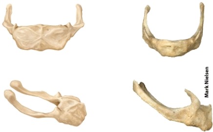 <strong>The illustrated bone is the _____?  </strong> A) atlas B) hyoid bone C) axis D) vomer <div style=padding-top: 35px> 