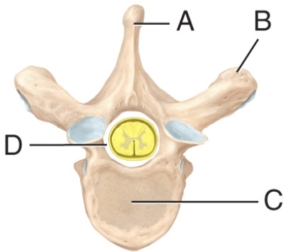 The label on the transverse process of the vertebra is _____.   A)  A B)  B C)  C D)  D