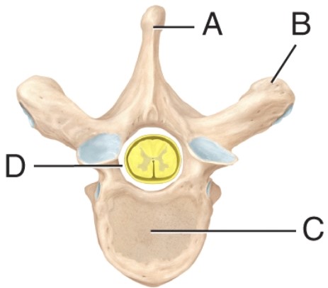The label on the spinous process is _____.   A)  A B)  B C)  C D)  D