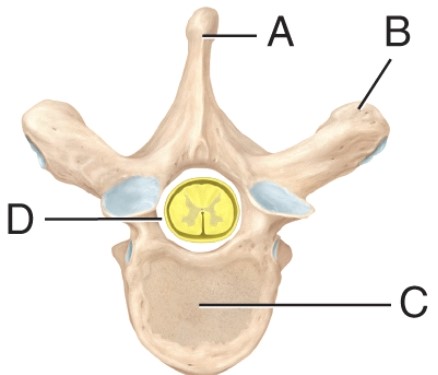 The label on the vertebral foramen is _____.   A)  A B)  B C)  C D)  D