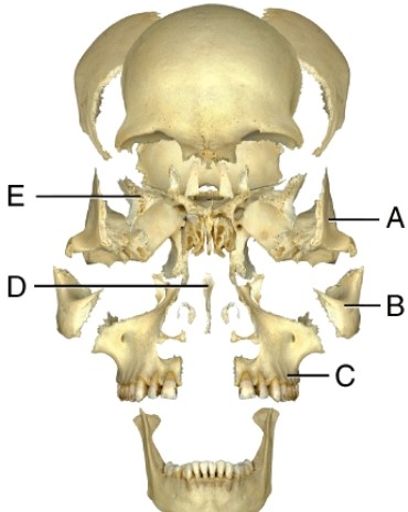 Where is the zygomatic bone?   A)  A B)  B C)  C D)  D E)  E