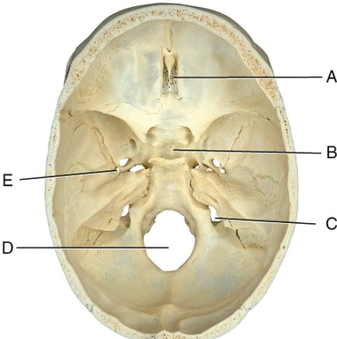 Where is the pituitary gland located?   A)  A B)  B C)  C D)  D E)  E