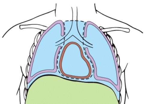 What type of section was performed on this torso?  