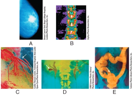 Which radiographs were obtained using low-dose x-rays?   A) (A) and (B)  B) (B) and (C)  C) (C) and (D)  D) (A) and (C)  E) (B) and (E) 