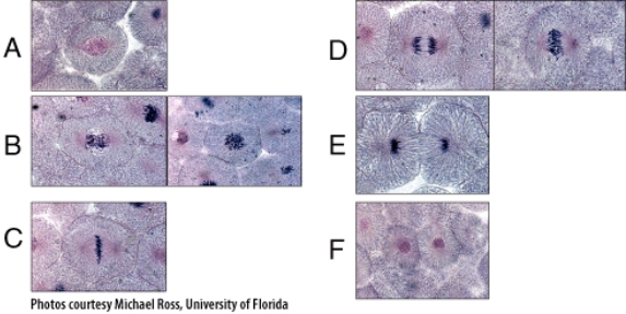 In the diagram,which panel shows events occurring during anaphase?   A) A B) B C) C D) D E) E