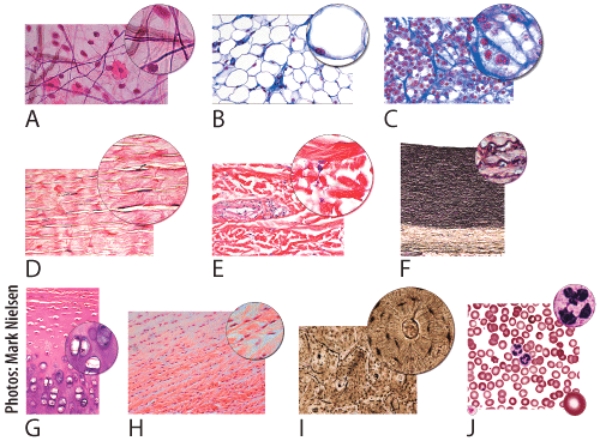 In the figure shown,which light micrograph shows the type of connective tissue that contains the Hardest matrix of all connective tissues?   A) J B) I C) G D) B E) D