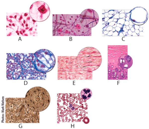 Which of the following figures shows tissue that is found in the trachea?   A) B B) C C) E D) F E) G