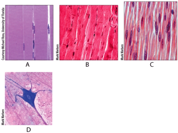 Which is a function of the tissue shown in diagram A?   A) heat production B) pumping of blood C) propulsion of food D) contraction of bladder E) conduct nerve impulses to muscle fibers