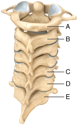 Which of the cervical vertebrae contain a unique process that is responsible for the ability to move your head from side to side signifying  no ?   A) A B) B C) C D) D E) E