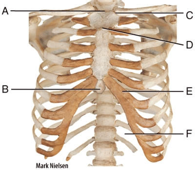 Where is the clavicular notch?   A) A B) C C) D D) B E) F