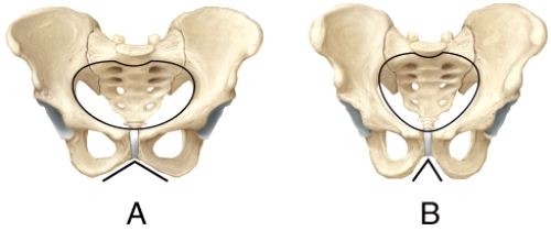 Which pelvis in the diagram shows the characteristics of a female pelvis?   A) A B) B C) Both are male.