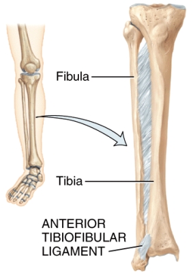 What type of joint is shown in the diagram?   A) Suture B) Syndesmosis C) Symphysis D) Cartilaginous E) Synovial