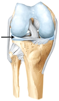 The line is pointing to the _____.   A) lateral meniscus B) medial meniscus C) anterior cruciate ligament D) posterior cruciate ligament
